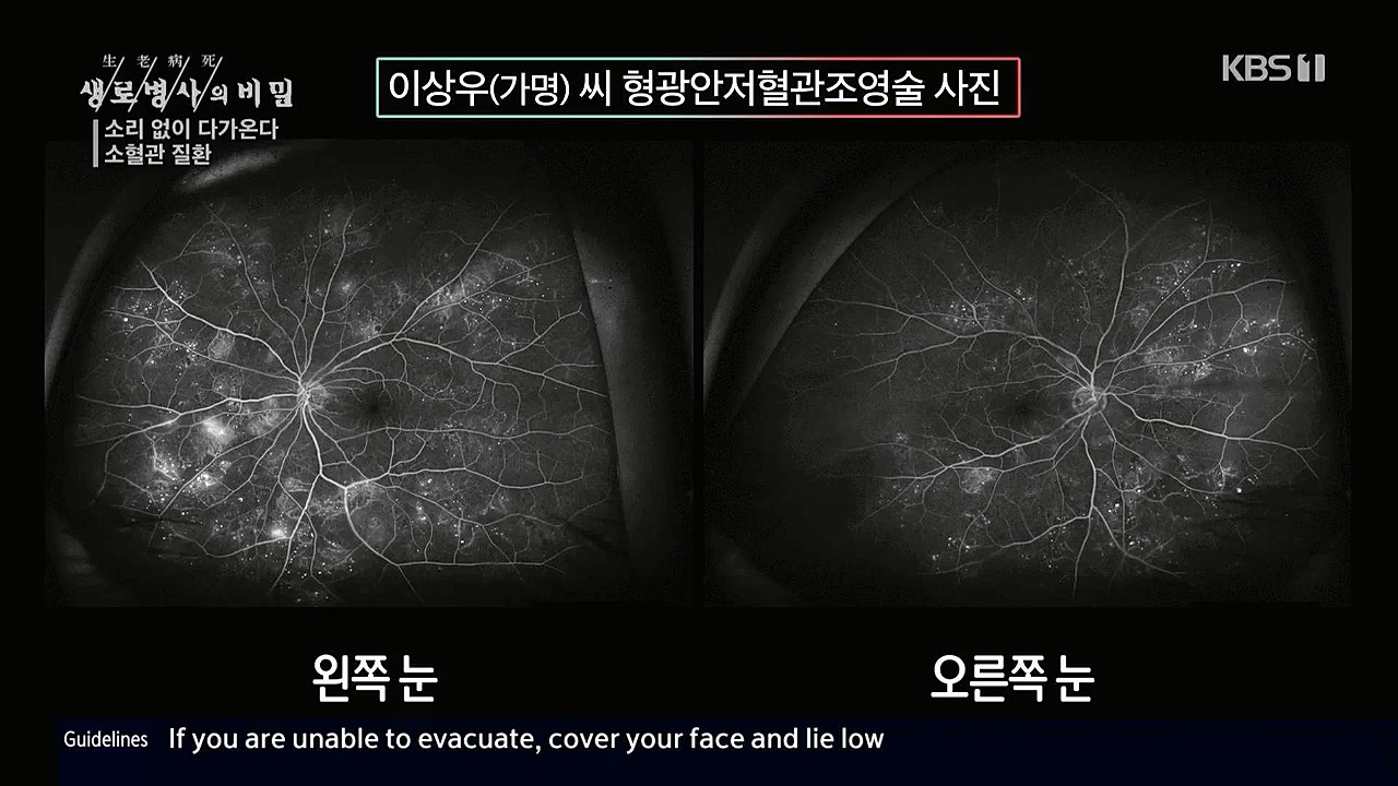 생로병사의비밀.E862.230309p.WANNA.mp4_20230309_194558.200.jpg
