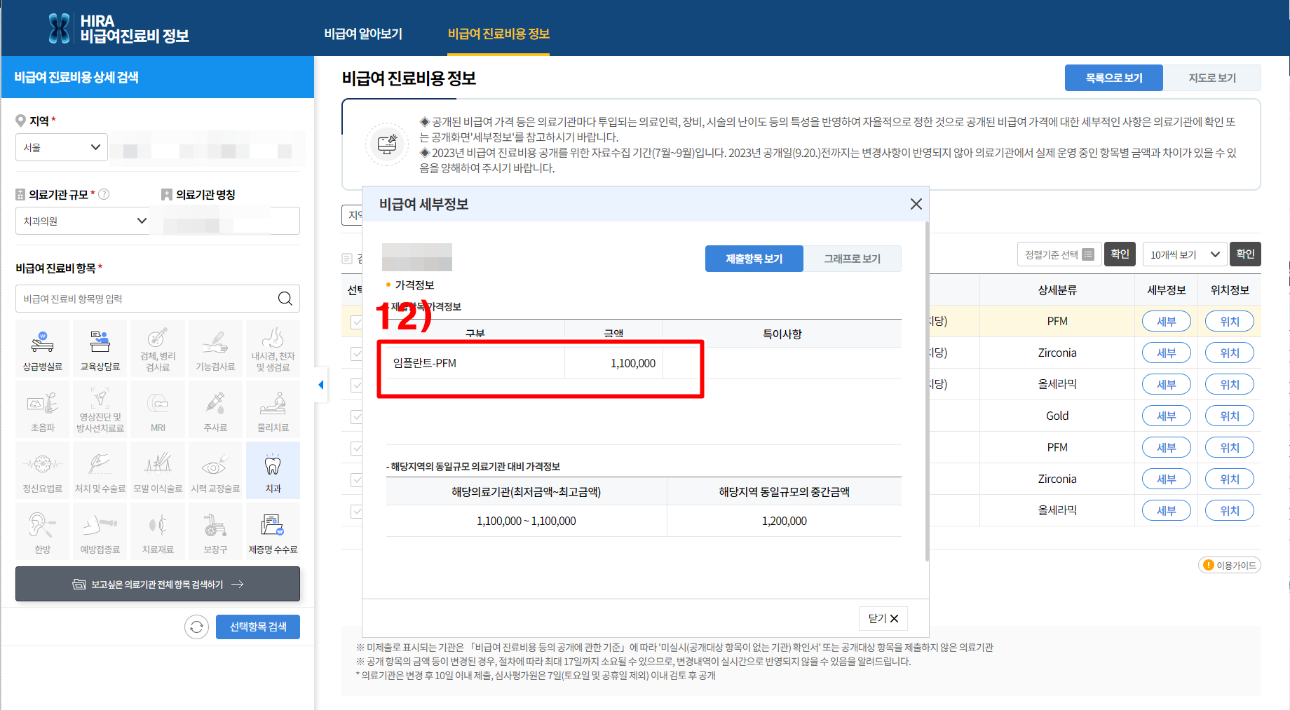 임플란트가격조회