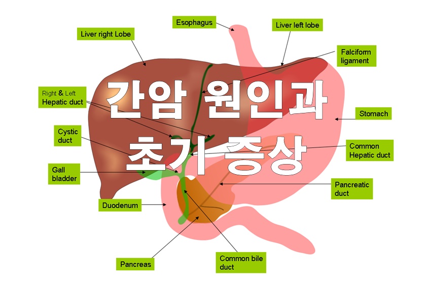  간암 초기증상 알아봤습니다.