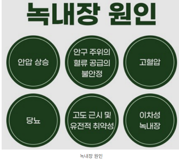 녹내장