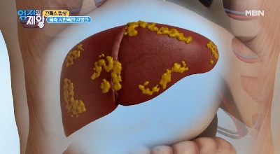  지방간 / 간 해독에 좋은 음식  구즙우유음 만드는방법