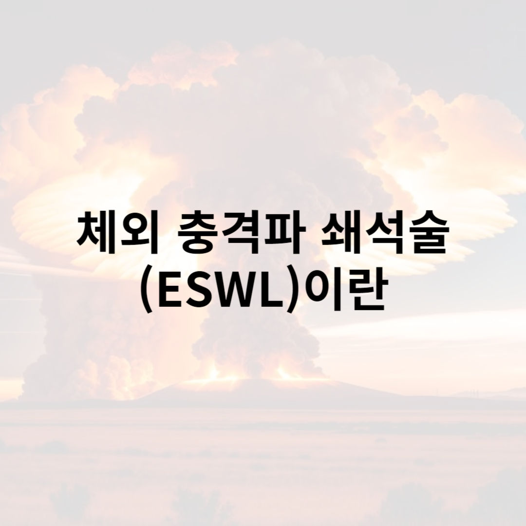 체외 충격파 쇄석술(ESWL)이란