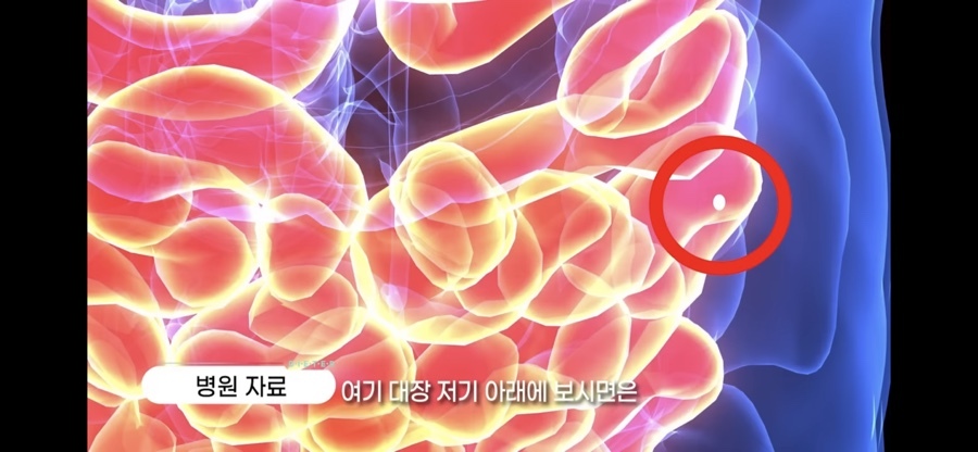 깍뚝 이미지
