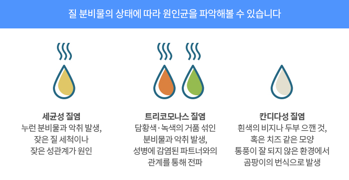 질염냉 냉색깔로 보는 질염