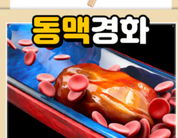 동맥경화-텍스트