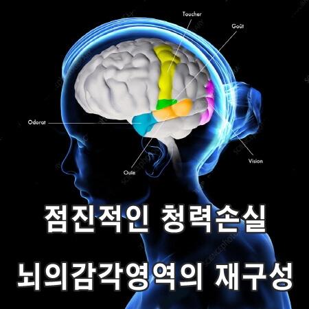  점진적인 청력 손실은 뇌의 감각 영역을 '재구성'하고 기억력을 손상시킵니다.(쥐 실험)