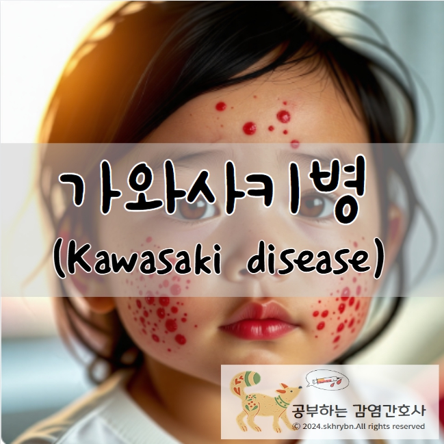 가와사키병(Kawasaki Disease)
