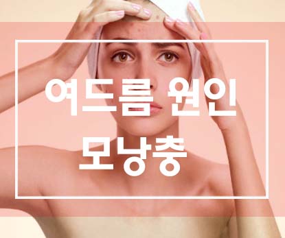  여드름의 원인 (1) 모낭충