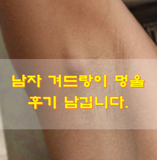  남자 겨드랑이 멍울 만져질때