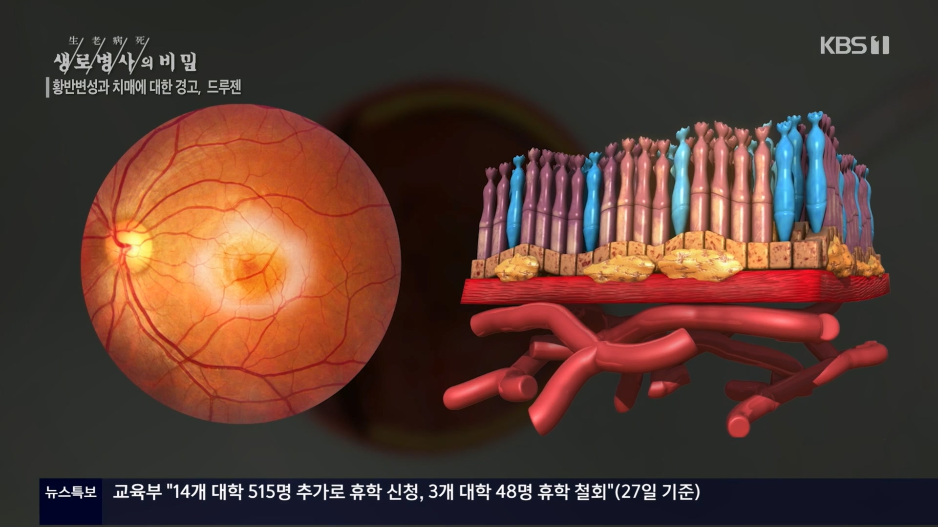 생로병사의 비밀.E899.240228p.H264-F1RST.mp4_20240229_202528.881.jpg