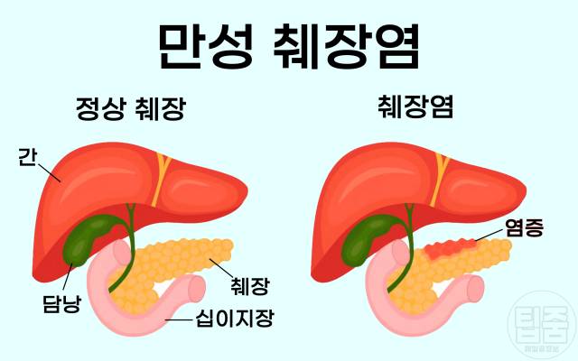 왜 배에 가스가 차나요?  배에 가스가 차서 아플 때 췌장염이 발생합니다.<br><br>