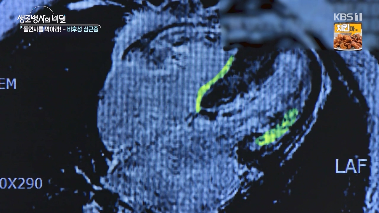 생로병사의 비밀.E912.240523p-NEXT.mp4_20240523_201957.482.jpg