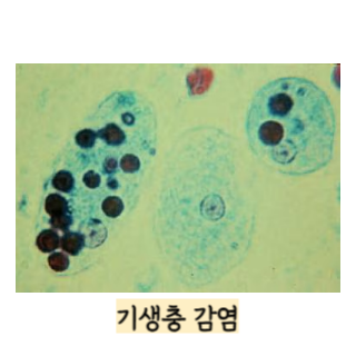 장염-증상-빨리-낫는-법