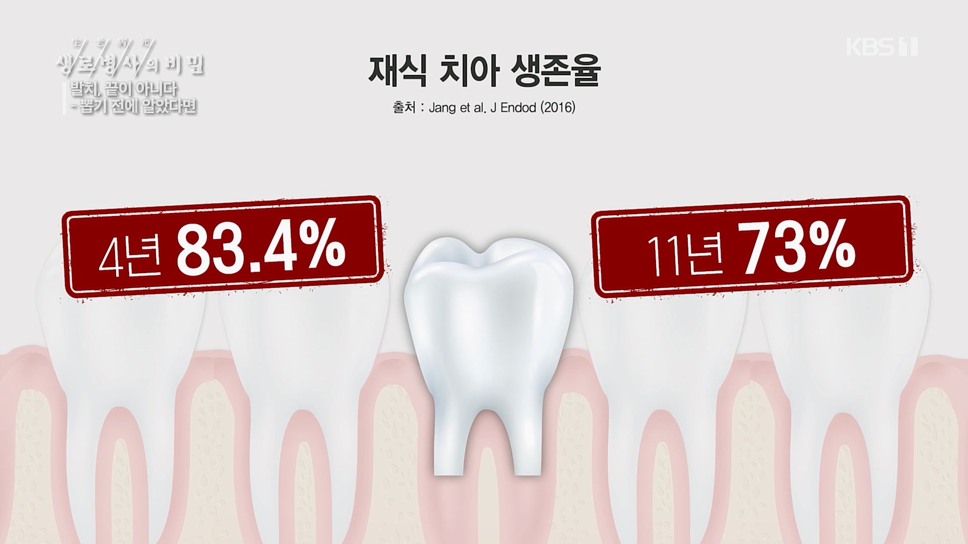 생로병사의 비밀.E855.230208p.H264-F1RST.mp4_20230214_194924.569.jpg
