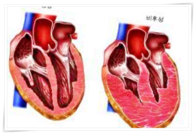 심병증