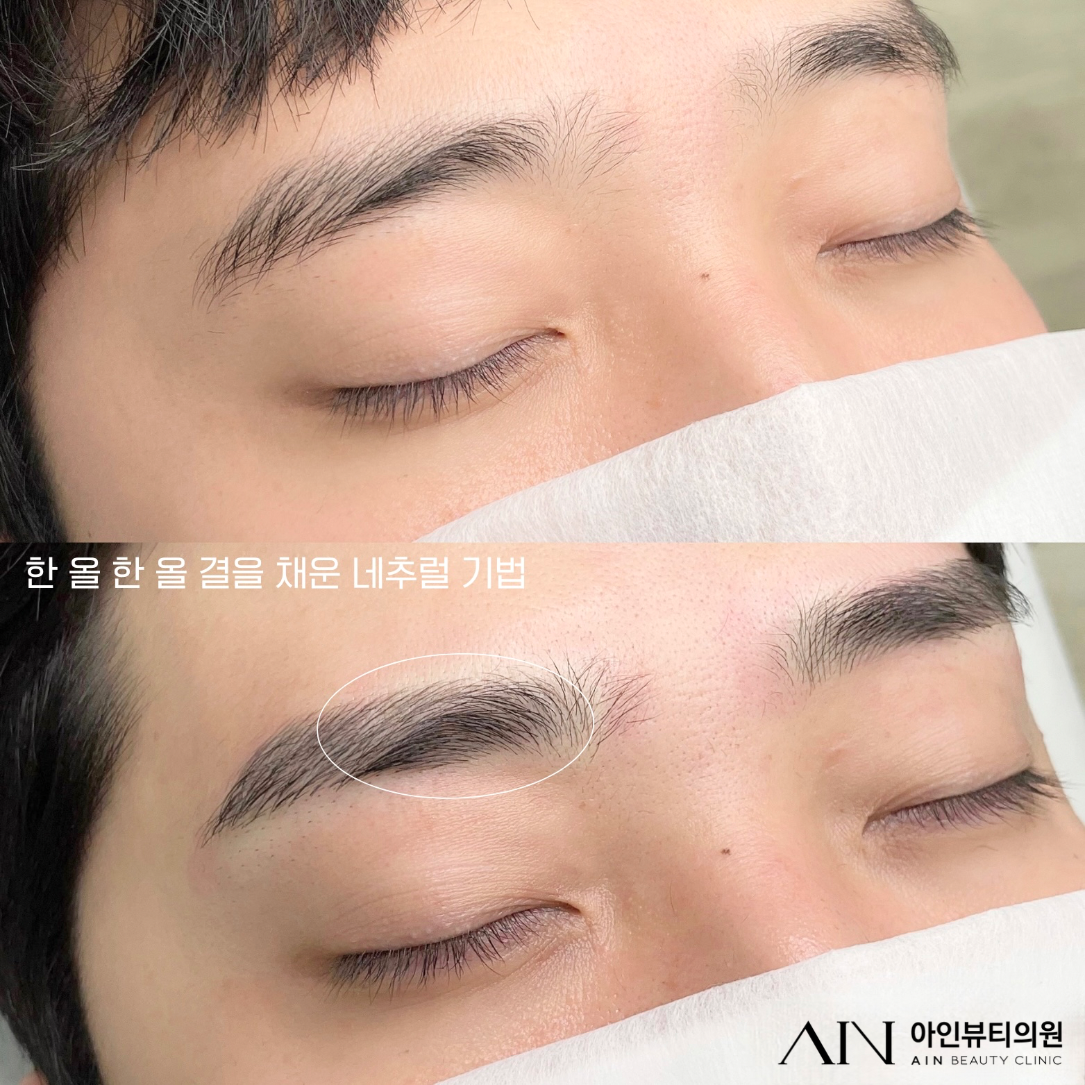  맨즈 네추럴 기법