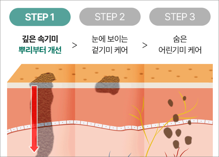 기미케어 단계