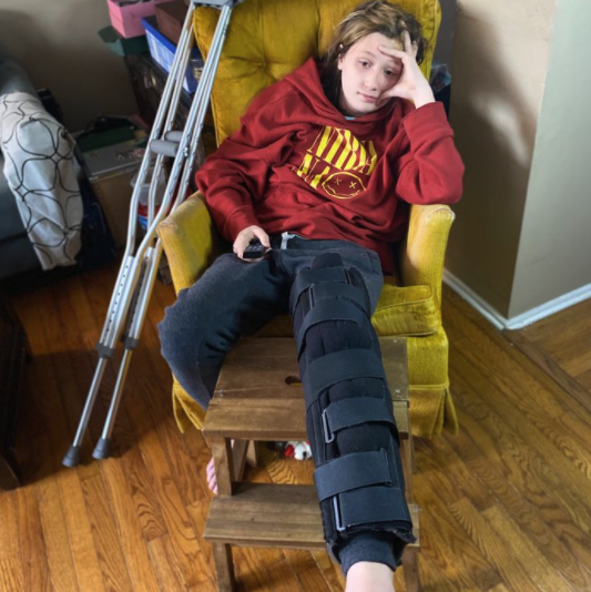 Baltimore teen Toby Robicelli fractured his kneecap while playing a VR game.
PHOTO: ALLISON ROBICELLI