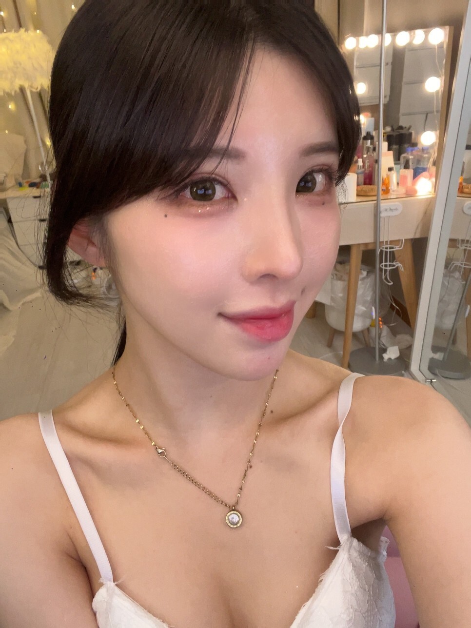  (3개월차 성형 후기) [눈재수술 +코재수술+얼굴(이마,)지방이식+턱끝전진술] 존예 에서 대존예로 ㄷㄷ -아름답tv-