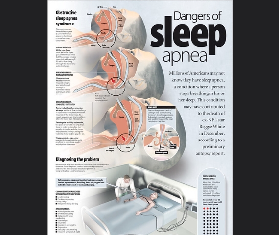 수면무호흡증의 주요 증상