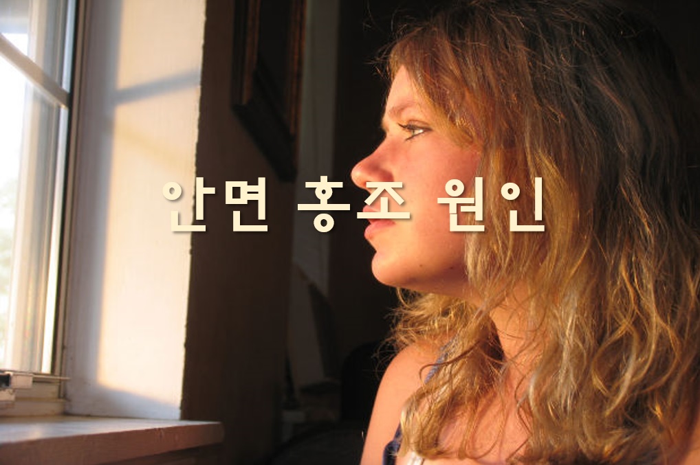  안면 홍조 원인과 없애는 법