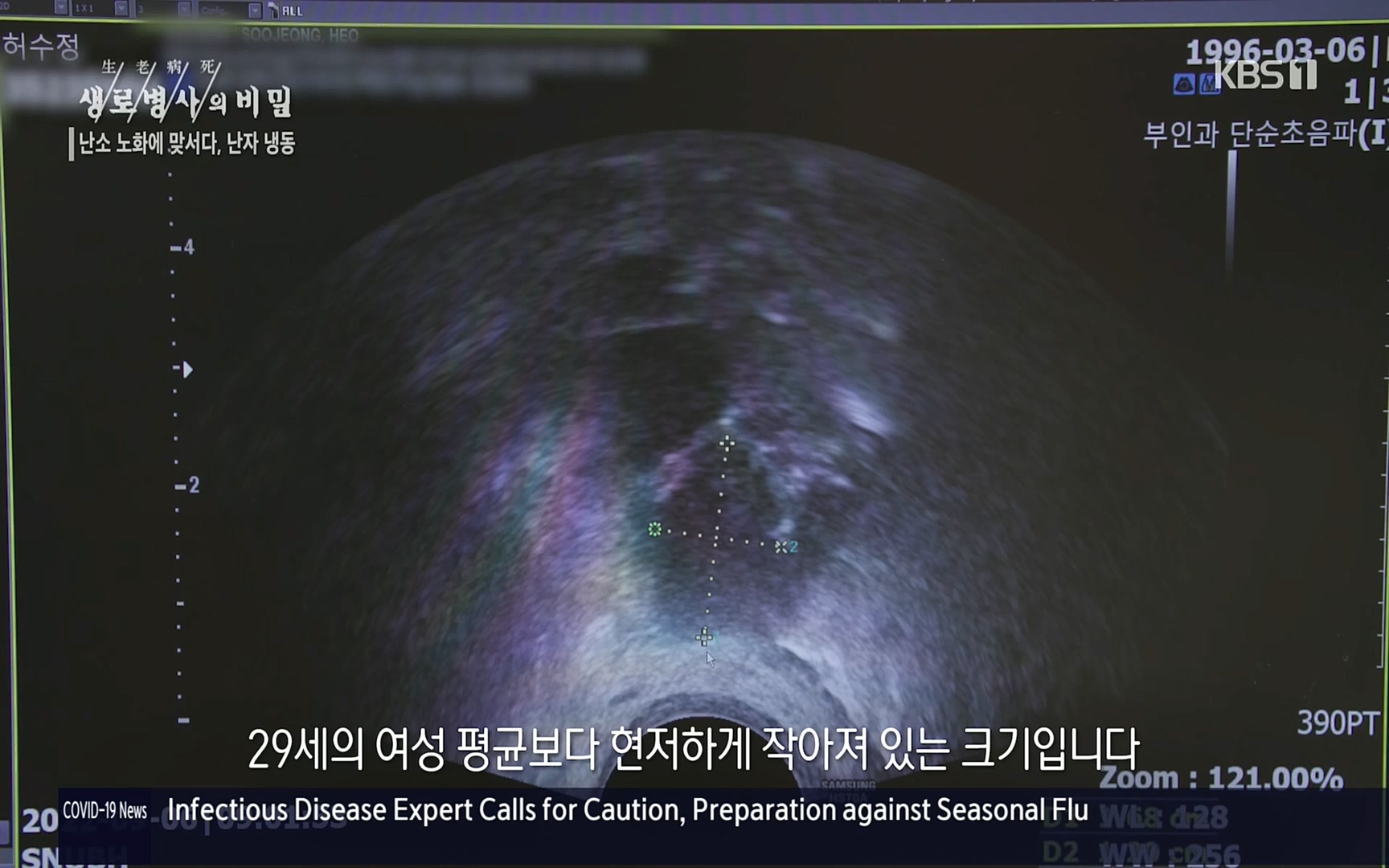 생로병사의 비밀.E836.220921p.H264-F1RST.mp4_20220925_183651.162.jpg