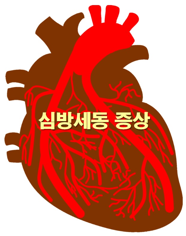  심방세동 증상과 심방세동 치료 방법