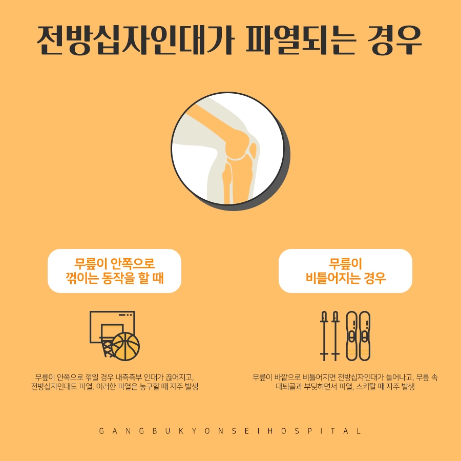 두 가닥 복원술 전방십자인대재건술 안정성을 높인
