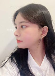 Facial Contouring, Rhinoplasty week3 review2