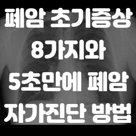 폐암 초기증상