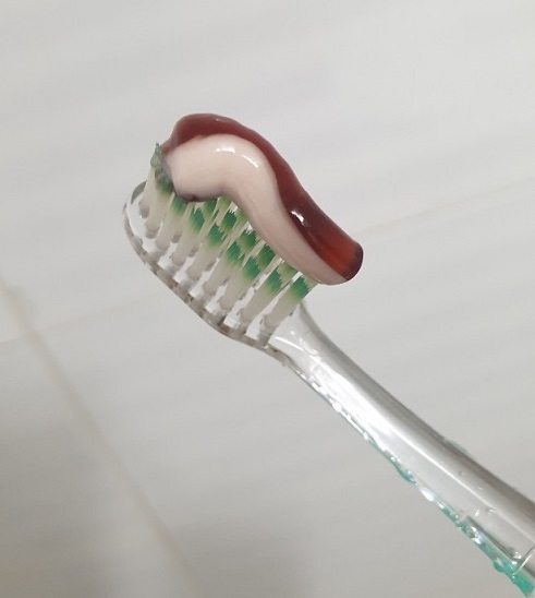  잇몸 치료 치약 잇치의 효과와 사용후기