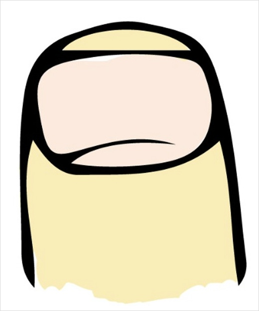 손톱모양 이미지