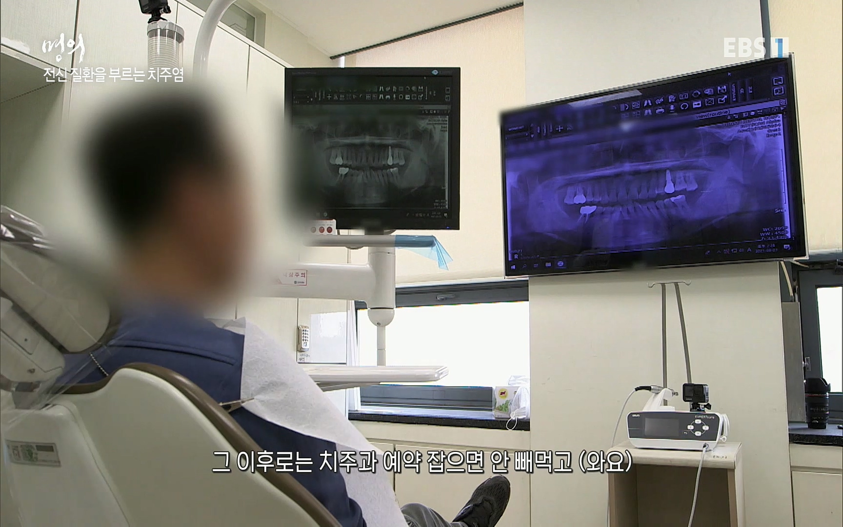 EBS 명의 헬스케어 - TV - 교육의 중심 EBS치주염이 코로나로 소홀해진 구강관리가 치아를 더 망가트리고 위험하게 만들며, 증상이 없기 때문에 특히 더 조심하고 치은염 단계에서 진행되지 않도록 예방해야한다 정의원 교수님과 치_20220505_151715.586.jpg