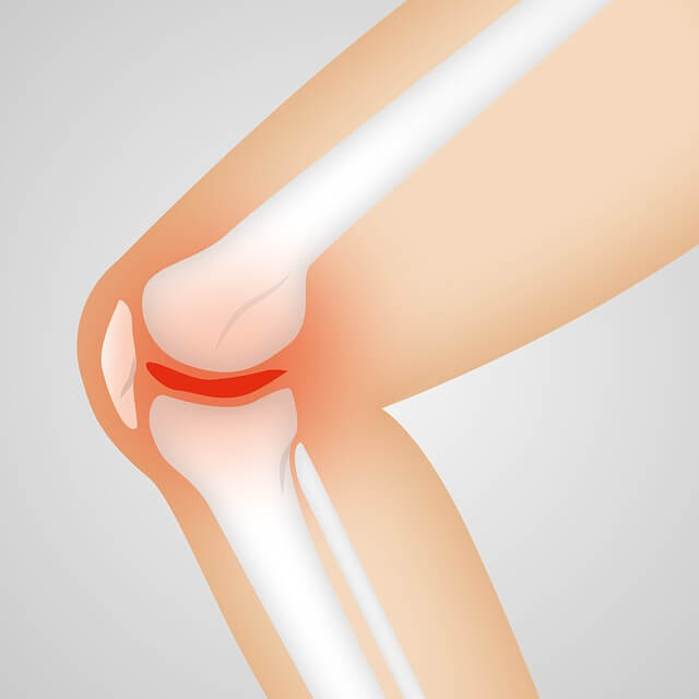 MSM은 연골&amp;#44; 뼈을 만드는 작용에도 관여하고 있어서 무릎에 좋습니다.