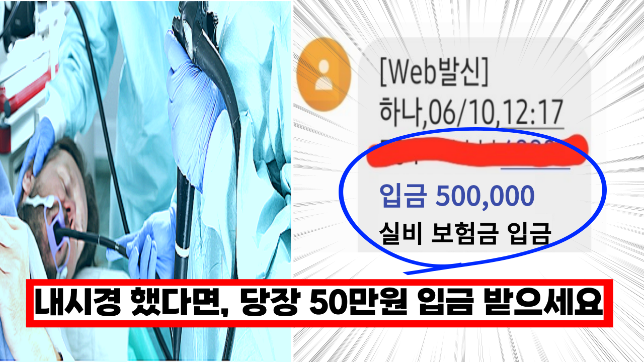  '당장 50만원 입금 받으세요' 내시경 검사 했다면  이 돈 꼭 받아가세요. 3년전 것도 지급 됩니다.