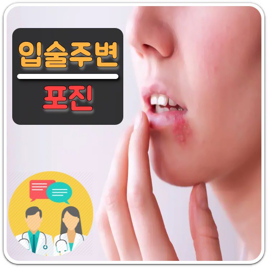 입주변-포진-수포-원인-치료-방법-안내