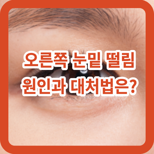 오른쪽 눈밑 떨림 원인과 대처법은?
