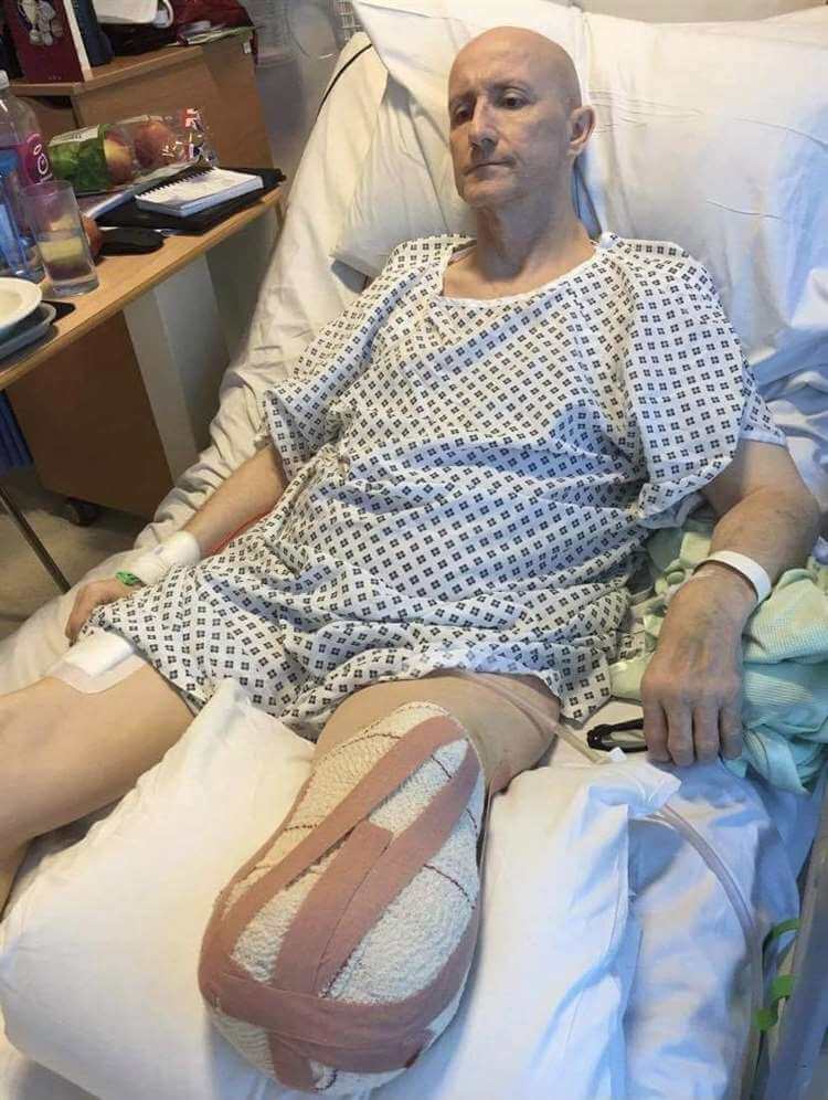  전 태권도 챔피언 영국 남성 AZ 접종 후 다리 절단  Stamford man vows to battle back after losing his leg weeks after receiving AstraZeneca Covid-19 vaccination