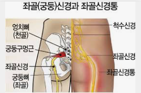 피부가 따끔거리는 증상