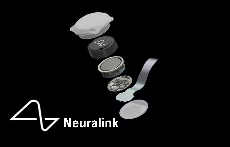 뉴럴링크-Neuralink-설명-이미지