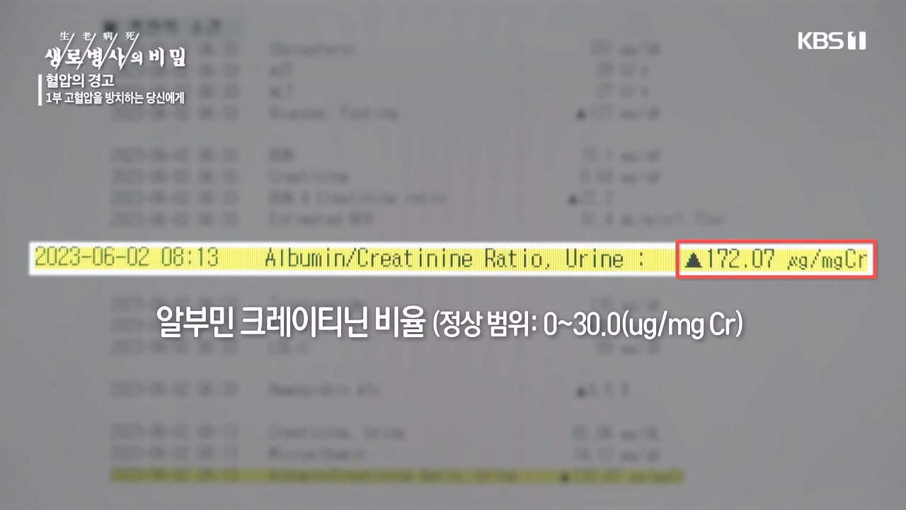 생로병사의 비밀.E887.231026p-NEXT.mp4_20231026_202924.077.jpg