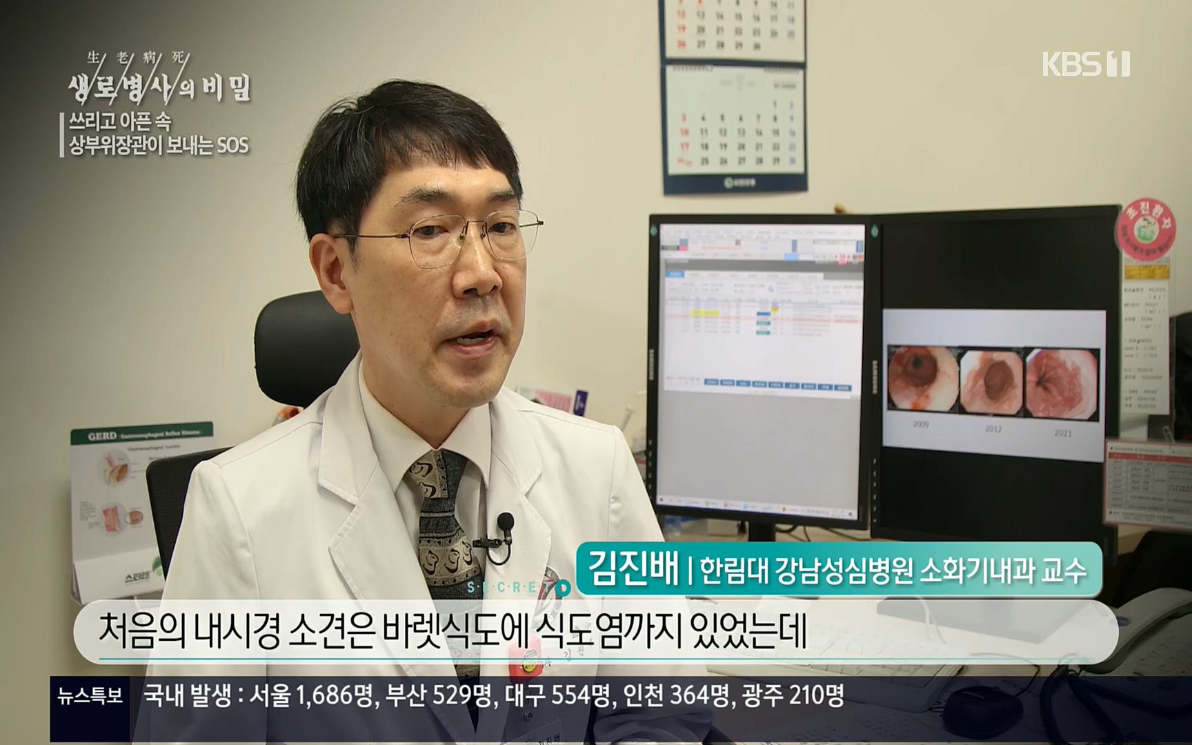 생로병사의 비밀.E822.220615p.H264-F1RST.mp4_20220616_203139.853.jpg