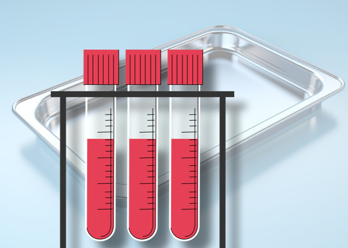 혈액샘플-3개