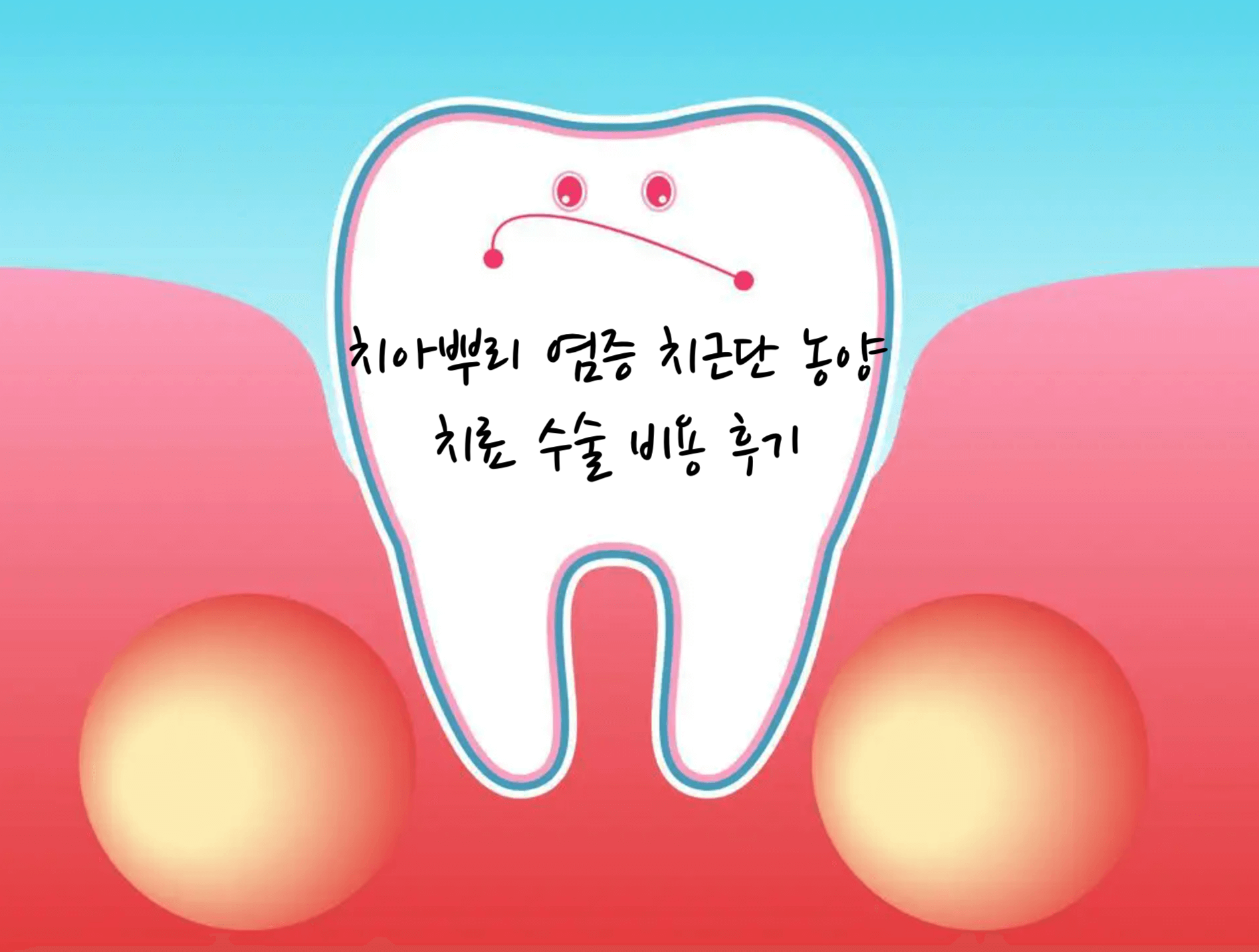 치아뿌리 염증