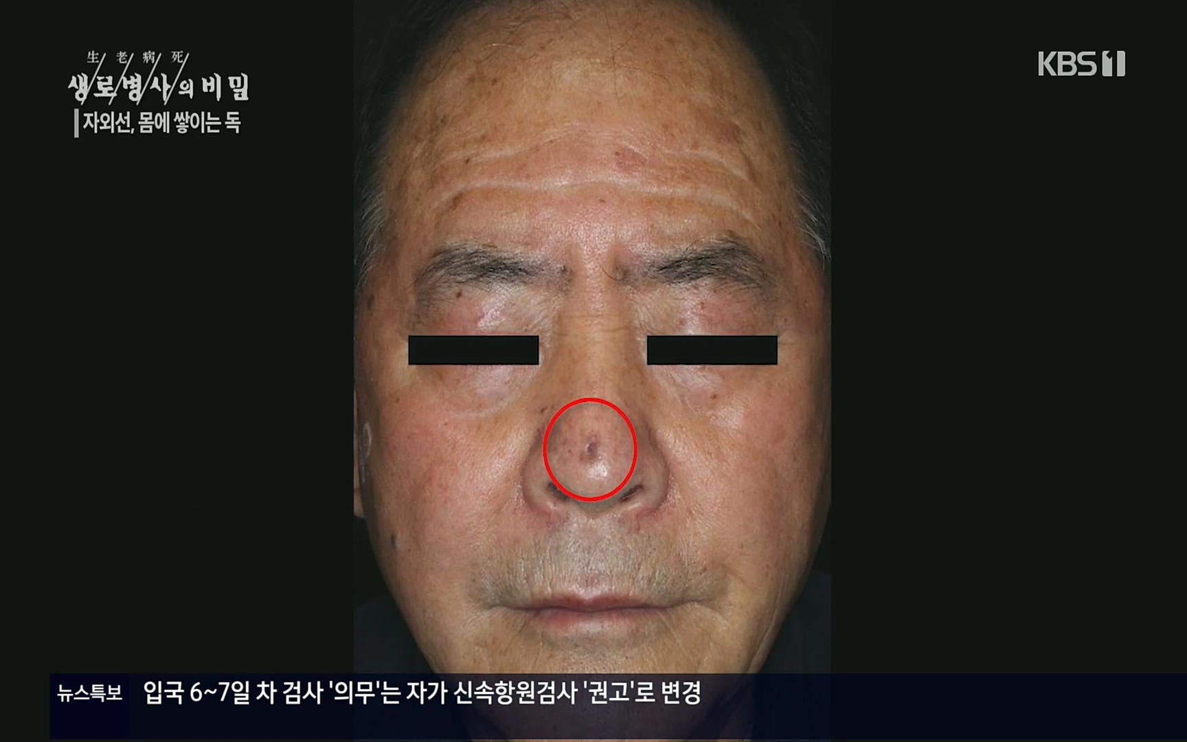 생로병사의 비밀.E824.220629p.H264-F1RST.mp4_20220630_203738.114.jpg