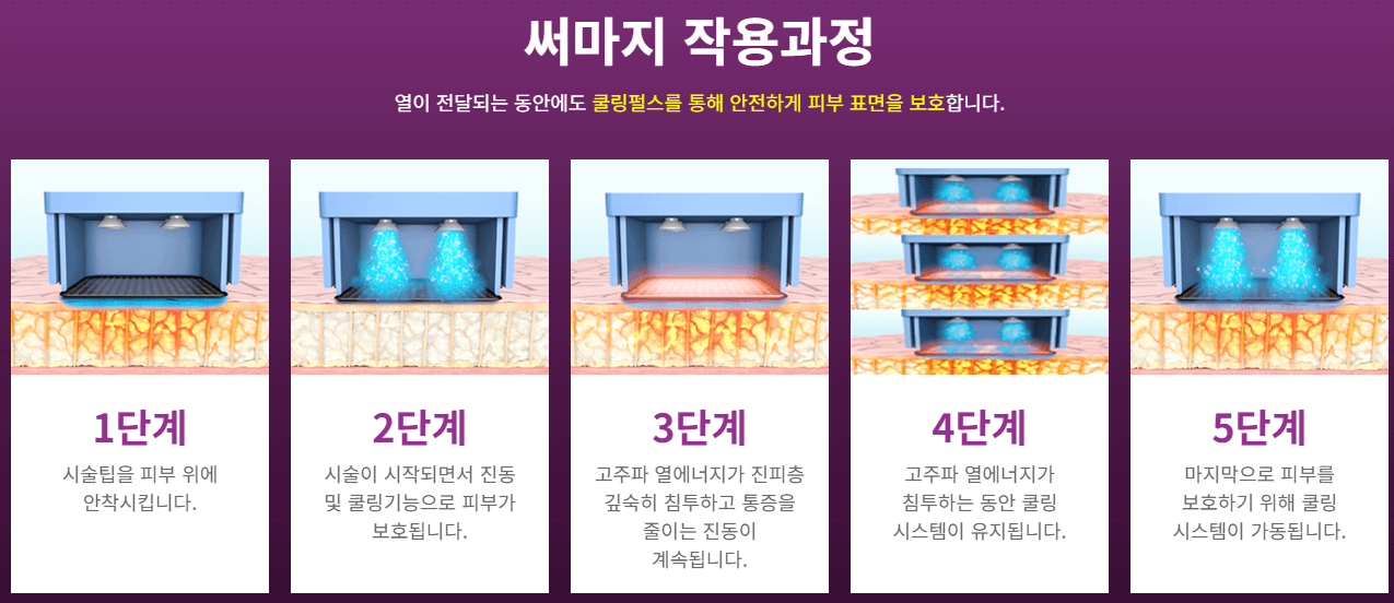 써마지 flx 효과 가격 써마지 후기