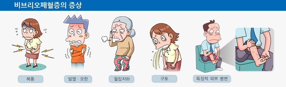  비브리오 패혈증 원인과 증상 예방 치료법
