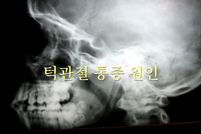  턱관절 통증 원인과 턱관절 치료 방법