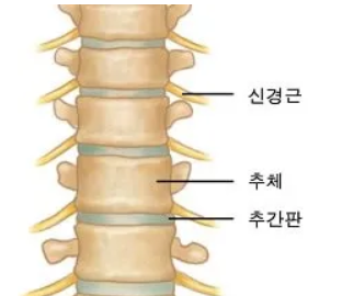 허리디스크