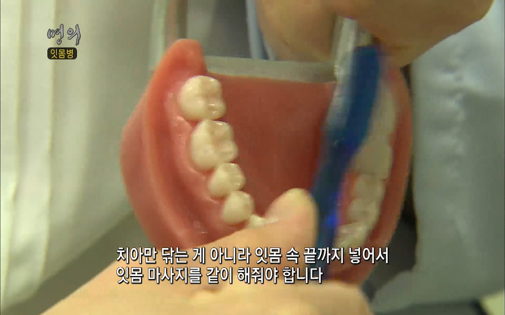 EBS 명의 헬스케어 - TV - 교육의 중심 EBS2015년 1월 16일 (금) 밤 9시 50분, EBS1.mp4_20220505_150409.150.jpg